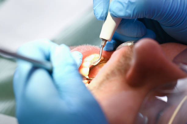 Best Dentist for Tooth Abscess  in Mount Rainier, MD