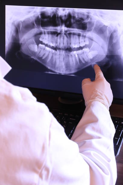 Best Teeth Whitening  in Mount Rainier, MD
